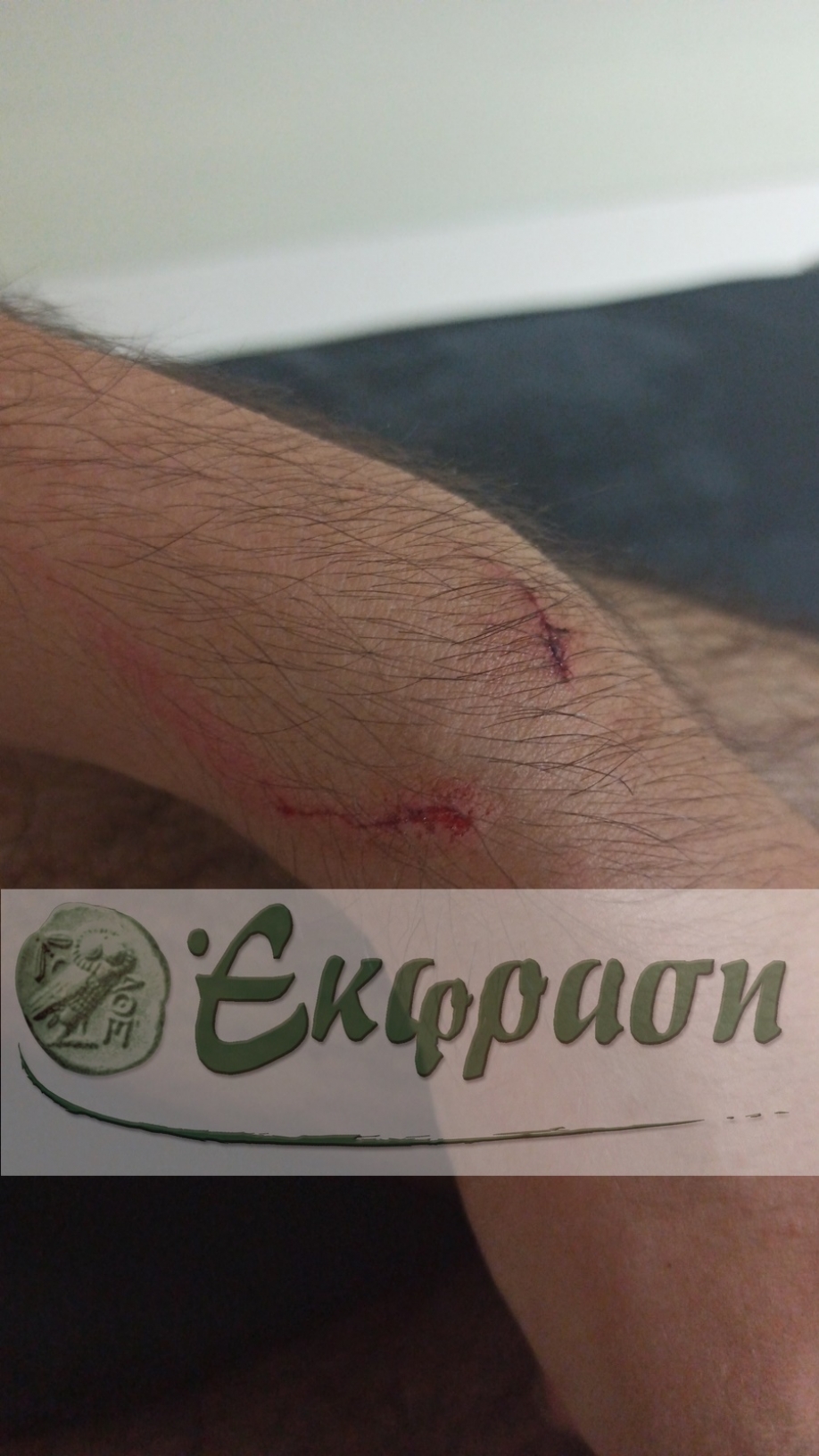 &Alpha;&pi;ί&sigma;&tau;&epsilon;&upsilon;&tau;&omicron; &pi;&epsilon;&rho;&iota;&sigma;&tau;&alpha;&tau;&iota;&kappa;ό &nu;&epsilon;&alpha;&nu;&iota;&kappa;ή&sigmaf; &beta;ί&alpha;&sigmaf; &sigma;&tau;&eta; &Mu;&epsilon;&tau;&alpha;&mu;ό&rho;&phi;&omega;&sigma;&eta;