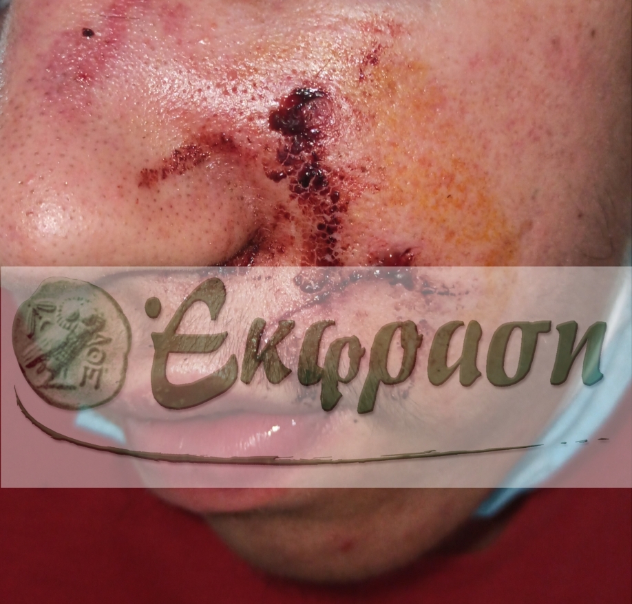 &Alpha;&pi;ί&sigma;&tau;&epsilon;&upsilon;&tau;&omicron; &pi;&epsilon;&rho;&iota;&sigma;&tau;&alpha;&tau;&iota;&kappa;ό &nu;&epsilon;&alpha;&nu;&iota;&kappa;ή&sigmaf; &beta;ί&alpha;&sigmaf; &sigma;&tau;&eta; &Mu;&epsilon;&tau;&alpha;&mu;ό&rho;&phi;&omega;&sigma;&eta;