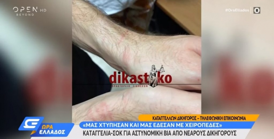 &Chi;&tau;ύ&pi;&eta;&sigma;&alpha;&nu; &kappa;&alpha;&iota; έ&delta;&epsilon;&sigma;&alpha;&nu; &mu;&epsilon; &chi;&epsilon;&iota;&rho;&omicron;&pi;έ&delta;&epsilon;&sigmaf; &delta;ύ&omicron; &delta;&iota;&kappa;&eta;&gamma;ό&rho;&omicron;&upsilon;&sigmaf; &sigma;&tau;&alpha; &Epsilon;&xi;ά&rho;&chi;&epsilon;&iota;&alpha; (Video)