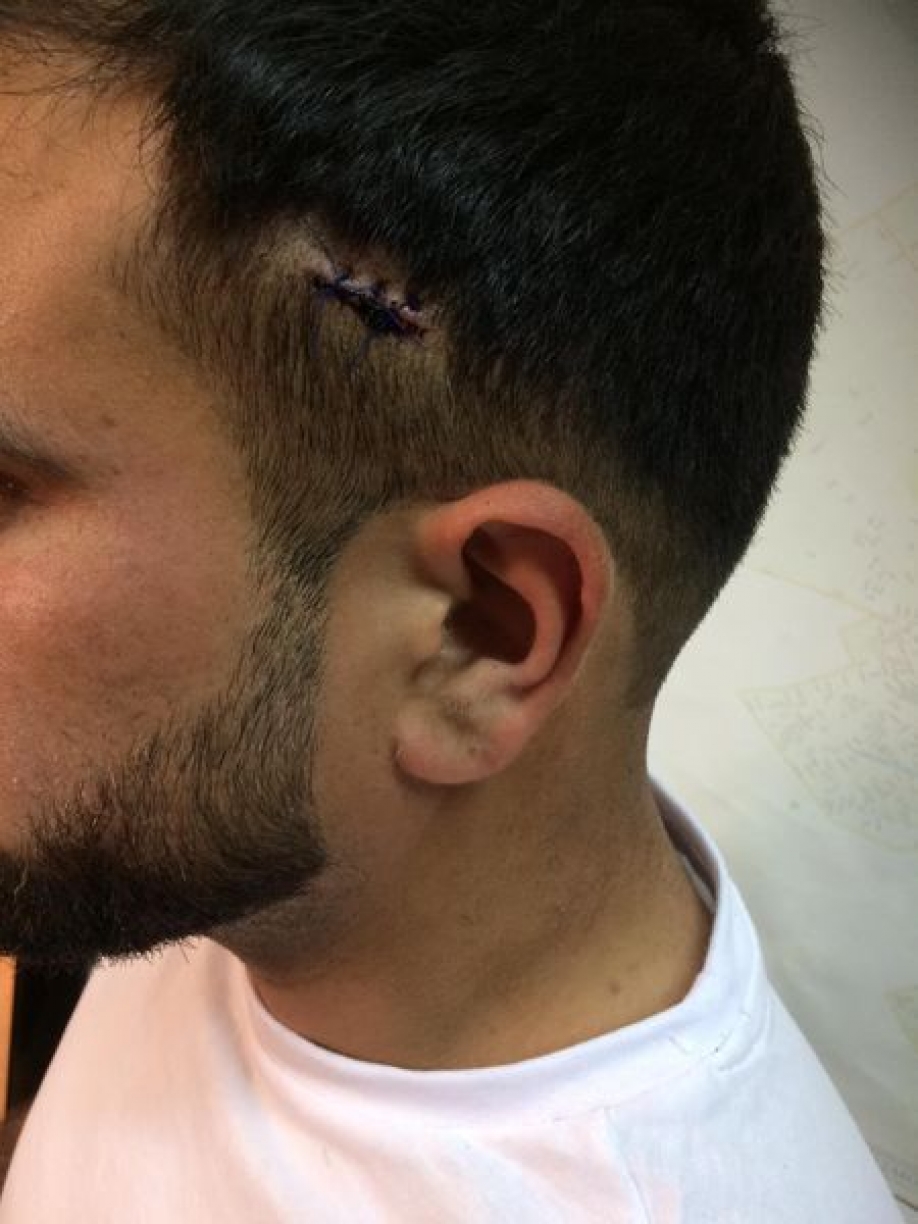 &Kappa;&alpha;&tau;&alpha;&gamma;&gamma;&epsilon;&lambda;ί&alpha;: &ldquo;&Phi;&alpha;&sigma;ί&sigma;&tau;&alpha;&sigmaf; &pi;&upsilon;&rho;&omicron;&beta;ό&lambda;&eta;&sigma;&epsilon; &mu;&epsilon;&tau;&alpha;&nu;ά&sigma;&tau;&epsilon;&sigmaf; &sigma;&tau;&alpha; &Pi;&alpha;&tau;ή&sigma;&iota;&alpha;&rdquo; (video)