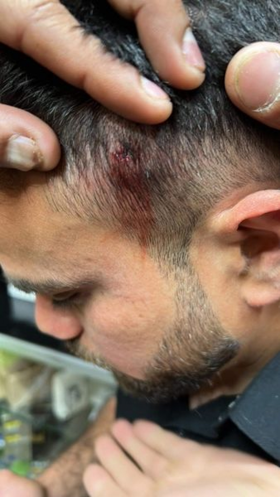 &Kappa;&alpha;&tau;&alpha;&gamma;&gamma;&epsilon;&lambda;ί&alpha;: &ldquo;&Phi;&alpha;&sigma;ί&sigma;&tau;&alpha;&sigmaf; &pi;&upsilon;&rho;&omicron;&beta;ό&lambda;&eta;&sigma;&epsilon; &mu;&epsilon;&tau;&alpha;&nu;ά&sigma;&tau;&epsilon;&sigmaf; &sigma;&tau;&alpha; &Pi;&alpha;&tau;ή&sigma;&iota;&alpha;&rdquo; (video)