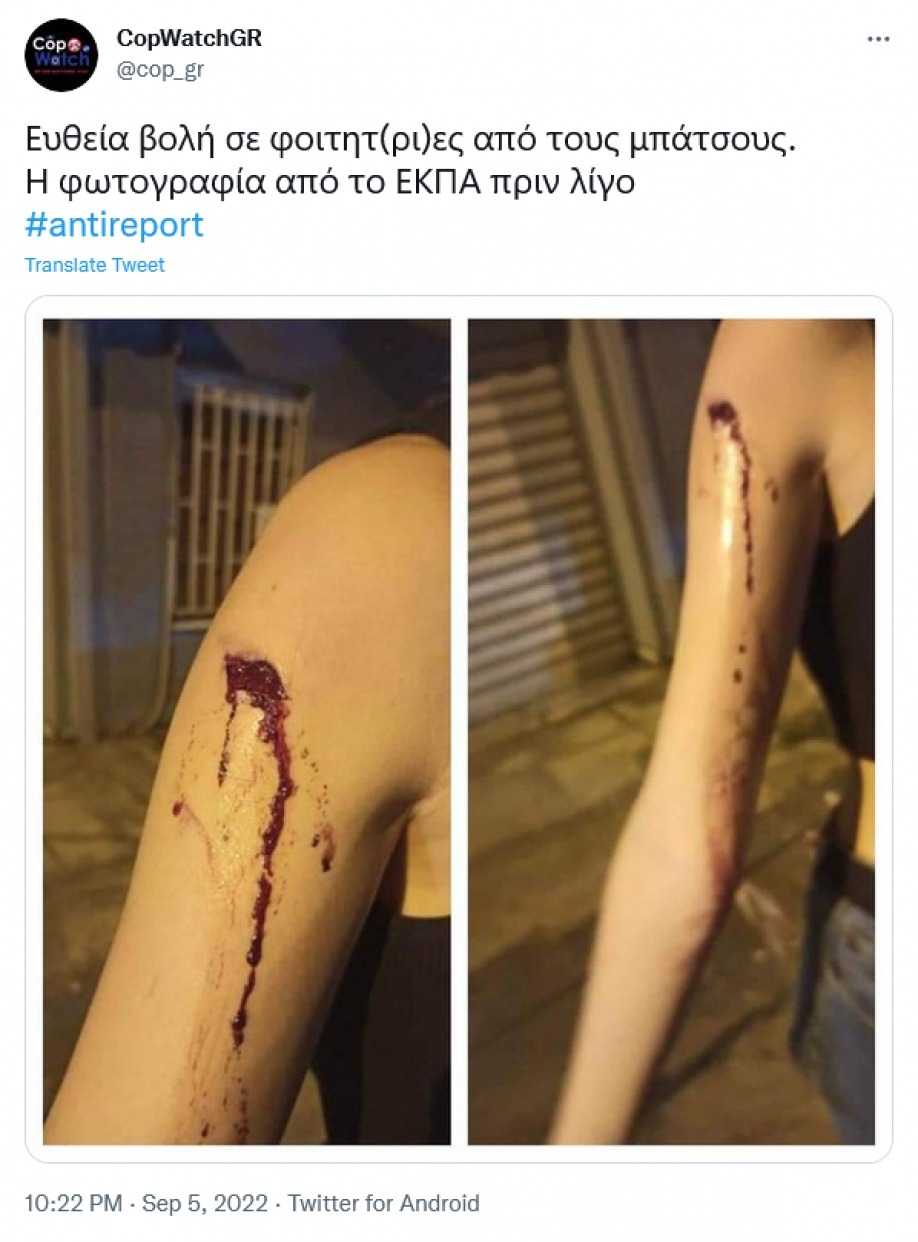 &ldquo;&Omicron; &lambda;&alpha;ό&sigmaf; &pi;&epsilon;&iota;&nu;ά&epsilon;&iota; &kappa;&iota; &epsilon;&sigma;&epsilon;ί&sigmaf; &phi;έ&rho;&nu;&epsilon;&tau;&epsilon; &tau;&eta;&nu; &pi;&alpha;&nu;&epsilon;&pi;&iota;&sigma;&tau;&eta;&mu;&iota;&alpha;&kappa;ή &alpha;&sigma;&tau;&upsilon;&nu;&omicron;&mu;ί&alpha;&rdquo; &ndash; &ldquo;&Mu;&pi;&lambda;ό&kappa;&omicron;&rdquo; &tau;&omega;&nu; &phi;&omicron;&iota;&tau;&eta;&tau;ώ&nu; &sigma;&tau;&eta;&nu; &Omicron;&Pi;&Pi;&Iota;