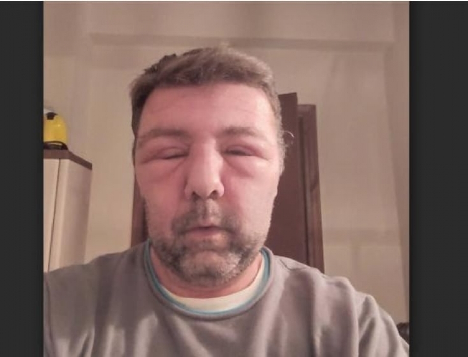 &Eta; &Pi;.&Omicron;.&Epsilon;. - &Omicron;.&Tau;.&Alpha;. &kappa;&alpha;&tau;&alpha;&gamma;&gamma;έ&lambda;&lambda;&epsilon;&iota; &tau;&eta;&nu; &epsilon;&pi;ί&theta;&epsilon;&sigma;&eta; &tau;&omega;&nu; &Mu;&Alpha;&Tau; &kappa;&alpha;&iota; &tau;&omicron;&nu; &tau;&rho;&alpha;&upsilon;&mu;&alpha;&tau;&iota;&sigma;&mu;ό &tau;&omicron;&upsilon; &Chi;&rho;ύ&sigma;&alpha;&nu;&theta;&omicron;&upsilon; &Kappa;&upsilon;&rho;&iota;&alpha;&zeta;ή