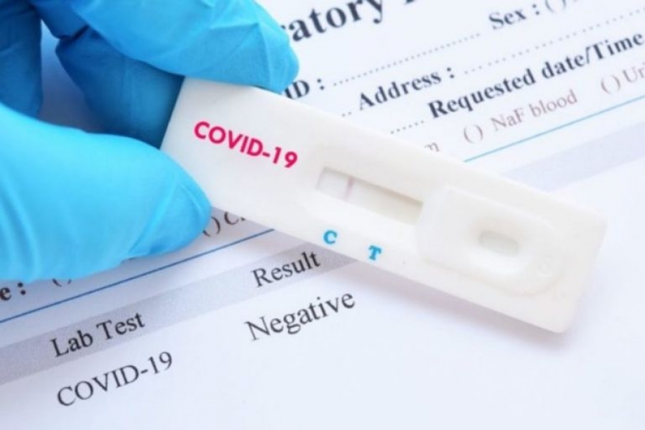 &Delta;ή&mu;&omicron;&sigmaf; &Mu;&epsilon;&tau;&alpha;&mu;ό&rho;&phi;&omega;&sigma;&eta;&sigmaf;: &Delta;&omega;&rho;&epsilon;ά&nu; rapid test &tau;&eta; &Delta;&epsilon;&upsilon;&tau;έ&rho;&alpha; 26/09