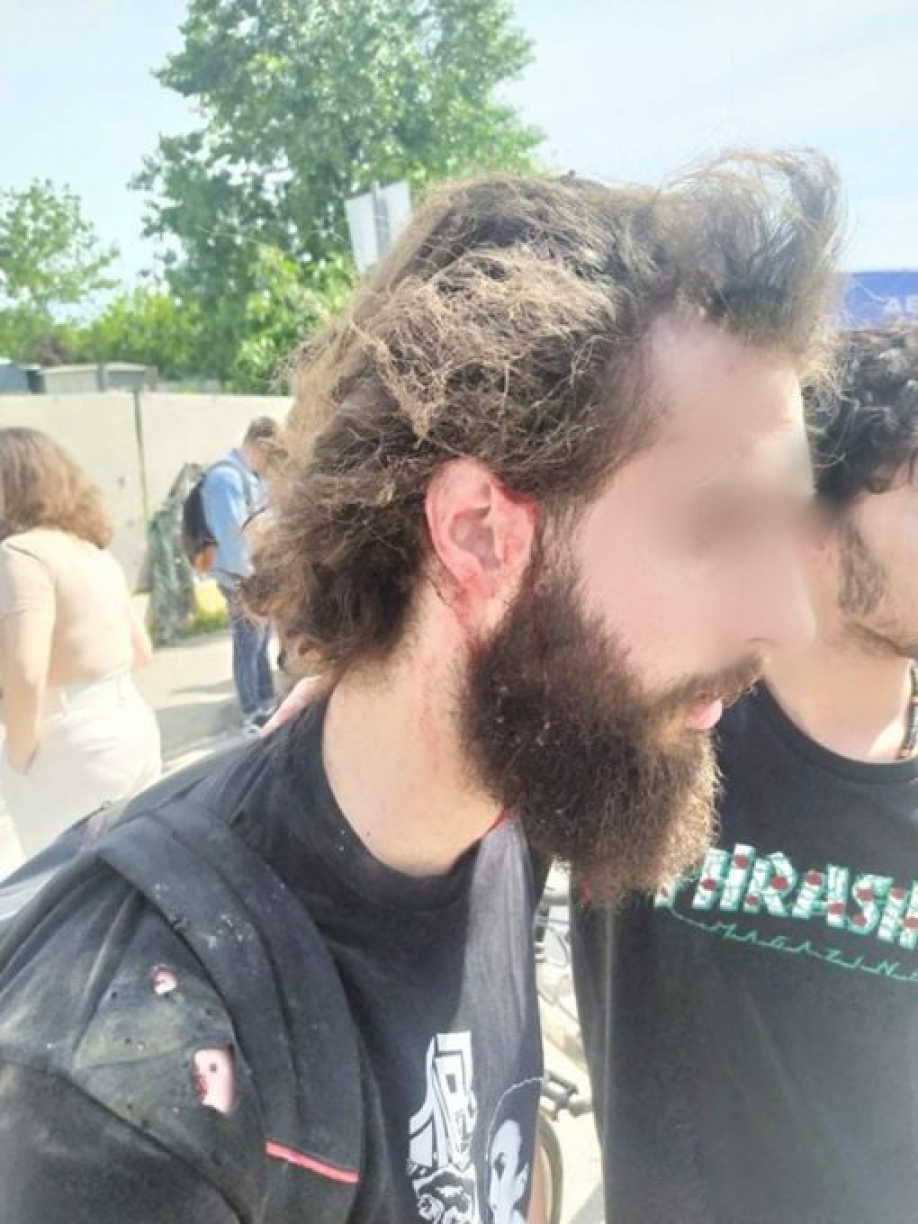 &Omicron;&rho;&gamma;&alpha;&nu;&omega;&mu;έ&nu;&omicron; &sigma;&chi;έ&delta;&iota;&omicron; &pi;&rho;&omicron;&beta;&omicron;&kappa;ά&tau;&sigma;&iota;&alpha;&sigmaf; &sigma;&tau;&omicron; &Alpha;&Pi;&Theta;; (video)