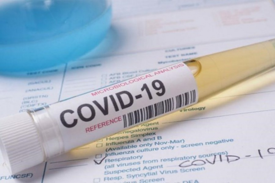 &Mu;&epsilon; &sigma;&pi;&alpha;&sigma;&mu;έ&nu;&alpha; &phi;&rho;έ&nu;&alpha; &eta; &pi;&alpha;&nu;&delta;&eta;&mu;ί&alpha; &ndash; &Omicron;&lambda;&omicron;&tau;&alpha;&chi;ώ&sigmaf; &gamma;&iota;&alpha; 20.000 &kappa;&rho;&omicron;ύ&sigma;&mu;&alpha;&tau;&alpha; &sigma;ή&mu;&epsilon;&rho;&alpha;